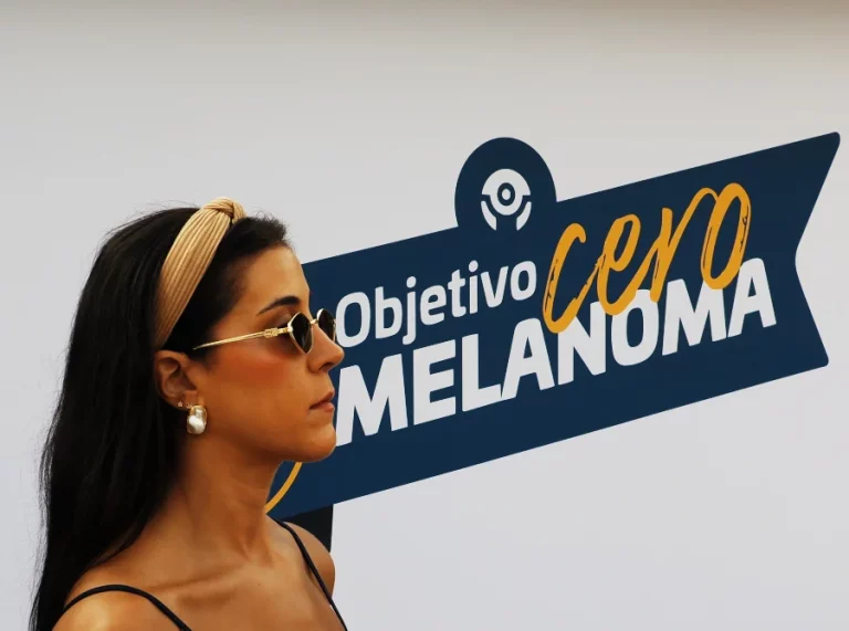 Prevención del melanoma en Málaga, una jornada de revisión de lunares